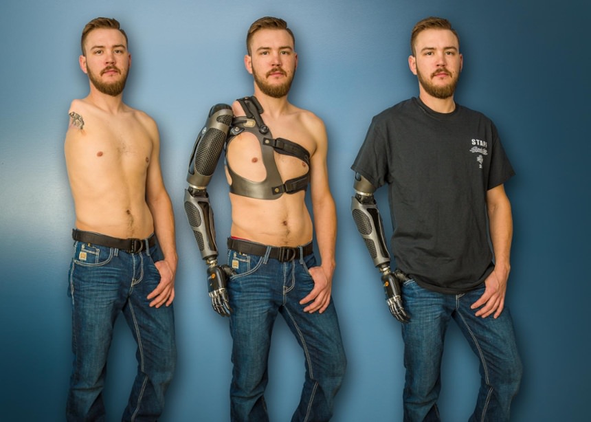 Featured Patients Arm Dynamics